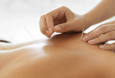 Akupuntur, Terapi Tusuk Jarum dengan Segudang Manfaat dan Minim Efek Samping