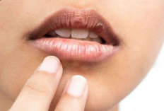 Bibir Hitam Tak Selalu karena Pakai Lipstik, Ini 5 Penyebab Aslinya