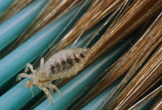 Ikuti Cara Ini, Dijamin Rambutmu Bisa Bebas dari Kutu yang Membandel 