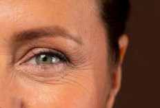 Ternyata Ini 7 Penyebab Keriput di Bawah Mata yang Bikin Wajah Tampak Tua