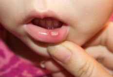 Wajib Coba, Obat Alami Ampuh Untuk Sariawan Anak Ada Untuk Bayi Juga