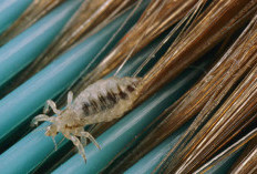 Cara ini Dijamin Ampuh Basmi Kutu Rambut pada Anak