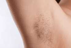 Ternyata Ada Manfaatnya, Ini 4 Alasan Kamu Tak Perlu Mencukur Bulu Ketiak