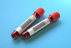 Cara Menaikkan Hb Darah dengan Cepat bagi Penderita Anemia