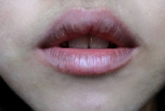 Selain Jeruk Nipis, Ternyata Ada Bahan Alami Lain yang Bisa Bantu Cerahkan Bibir HItam