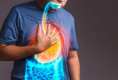 5 Pilihan Vitamin yang Bisa Bikin Asam Lambung (GERD) Jadi Tak Berkutik