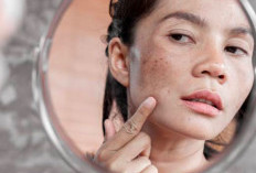 Ini Kandungan Skincare untuk Hilangkan Flek Hitam